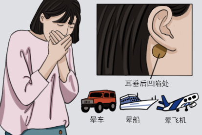 晕车贴贴在耳根哪里图片