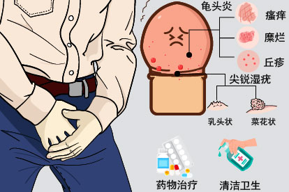 龟头下面长了小颗粒图