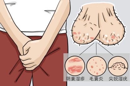 阴囊有白斑瘙痒图