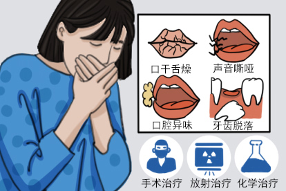 口腔癌中期图片