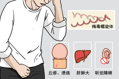 下疳样脓皮病图片