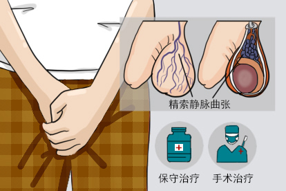 生殖器表皮静脉曲张图片