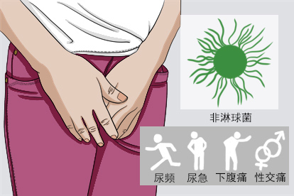非淋病图片