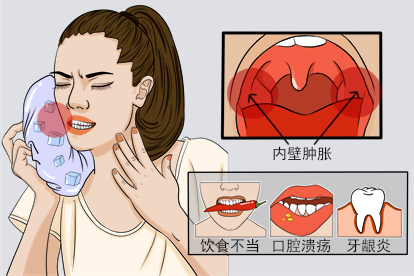 口腔内壁两边肿胀图片