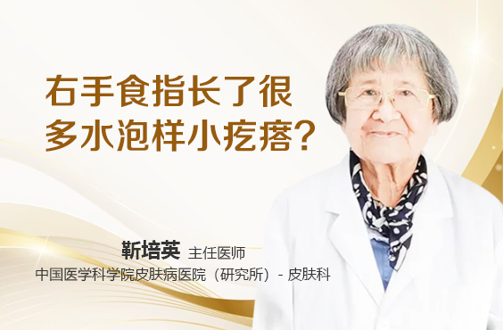 右手食指长了很多水泡样小疙瘩