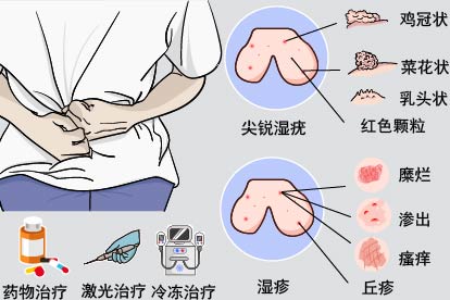 阴囊丘疹样子图