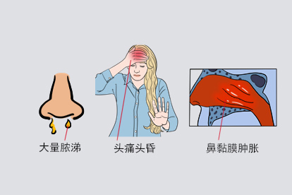 鼻窦炎鼻子里面长脓出血症状图