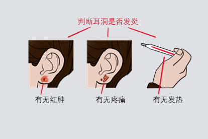 判断耳洞发炎图片