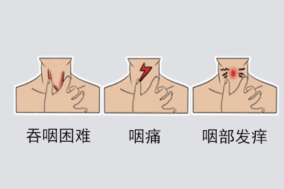 咽炎症状图片