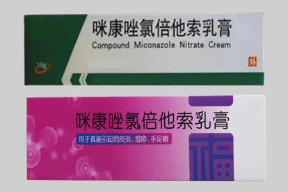 脸上长癣脂溢性皮炎治疗药物图