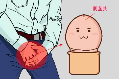 男人阴茎头图片