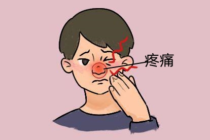 鼻窦炎引起疼痛图