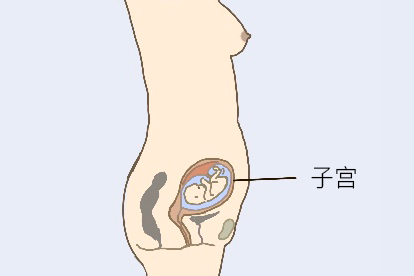 宫内孕图