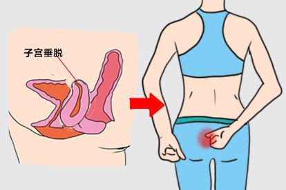 腰骶酸痛图