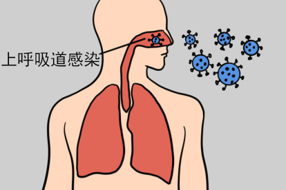 上呼吸道感染引发喉咙充血图片