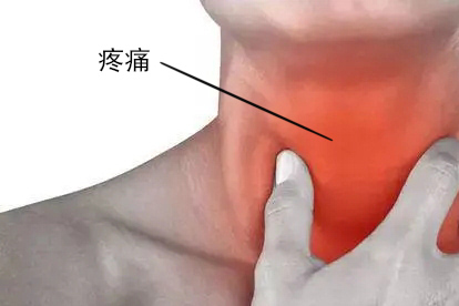 喉咙充血症状图片