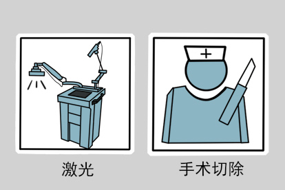 阴茎头上有黑点色素痣治疗图
