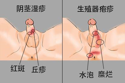 临床症状不同图