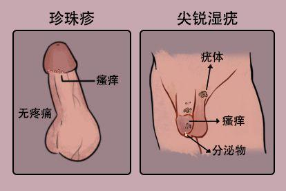 症状不同图