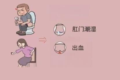 痔疮图