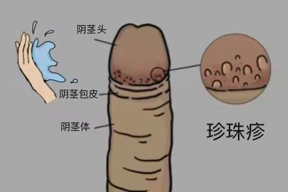 日常护理图