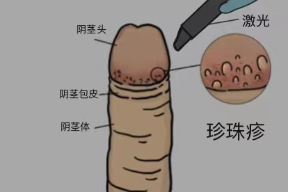 物理治疗图