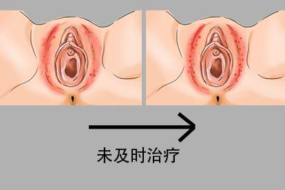 数量不等图
