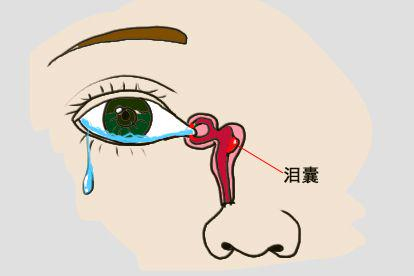 泪囊增生分泌物增多图