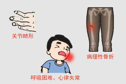 三期梅毒图