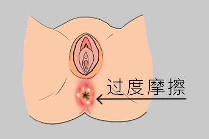 过度摩擦图