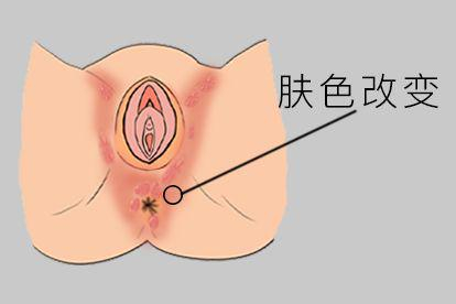 股癣图