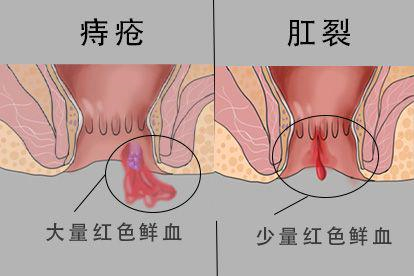出血症状不同图