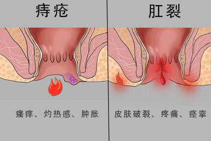 伴随症状不同图