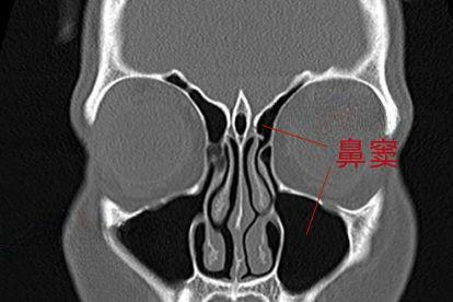 轴位片图