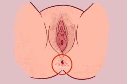 局部卫生不良图