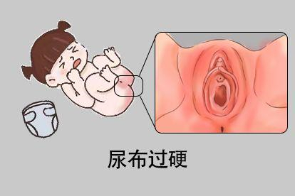 过度摩擦图
