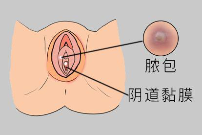 脓包图
