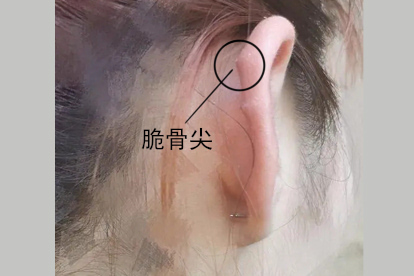 耳朵软骨上有软骨增生图片