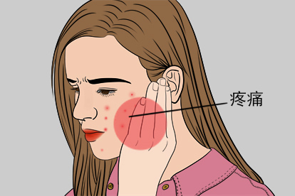 脸上长尖锐湿疣初期疼痛症状图