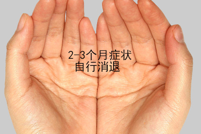梅毒斑块的发展过程图片
