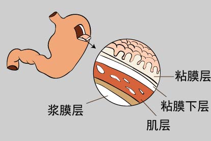 胃壁的分层结构图片
