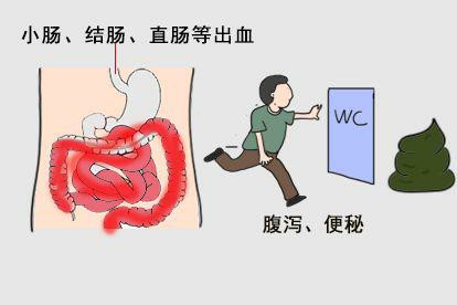 墨绿色大便颜色和病因图片