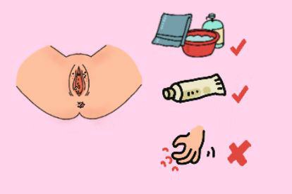 女性生殖器尖锐湿疣治疗图
