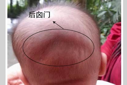 两个月婴儿后脑勺有凹陷图片
