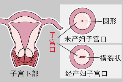 子宫口正常的照片