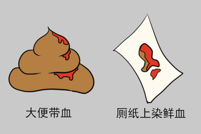 女生肛管皮肤破裂初期症状图片