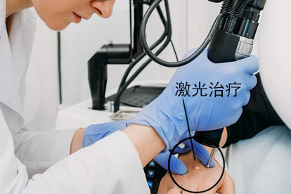 寻常疣物理治疗图