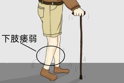 痿症图片