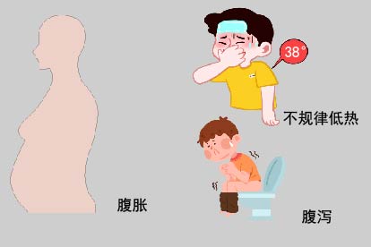 腹腔积液症状图片