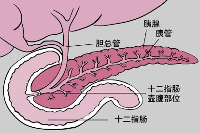 急性胰腺炎解剖图片